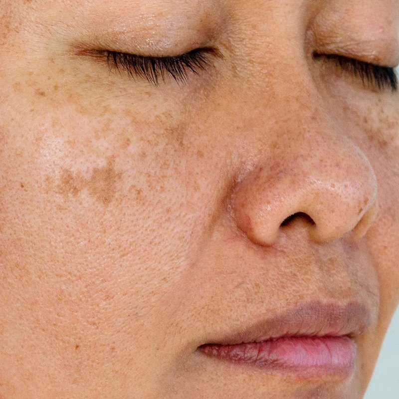 WhatsApp Image 2025-11-21 at 10.01.59 AM